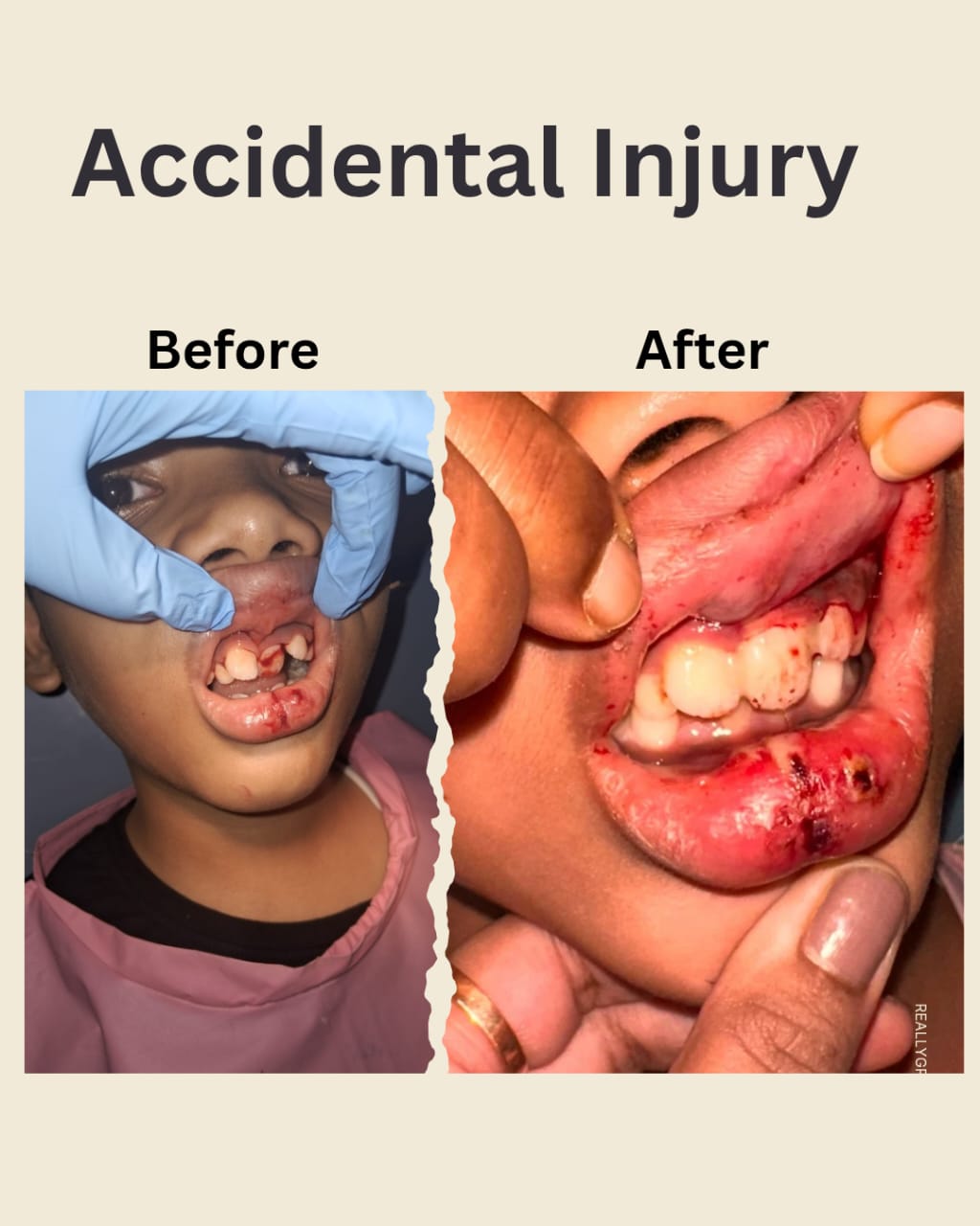 Patient smile at Indu Dental Clinics