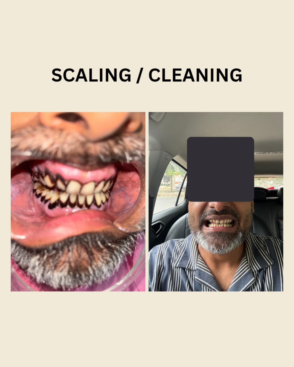 Patient smile at Indu Dental Clinics