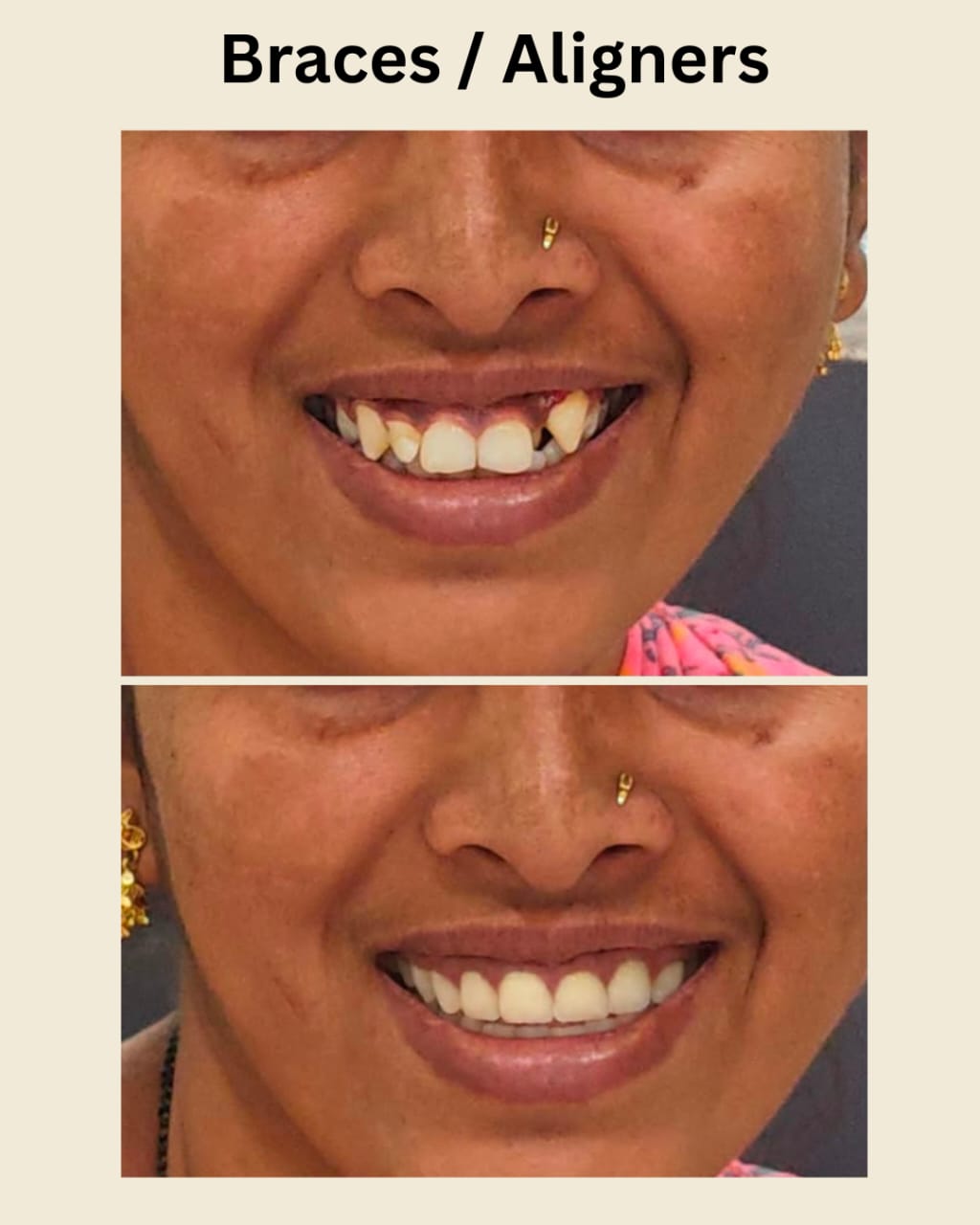 Patient smile at Indu Dental Clinics