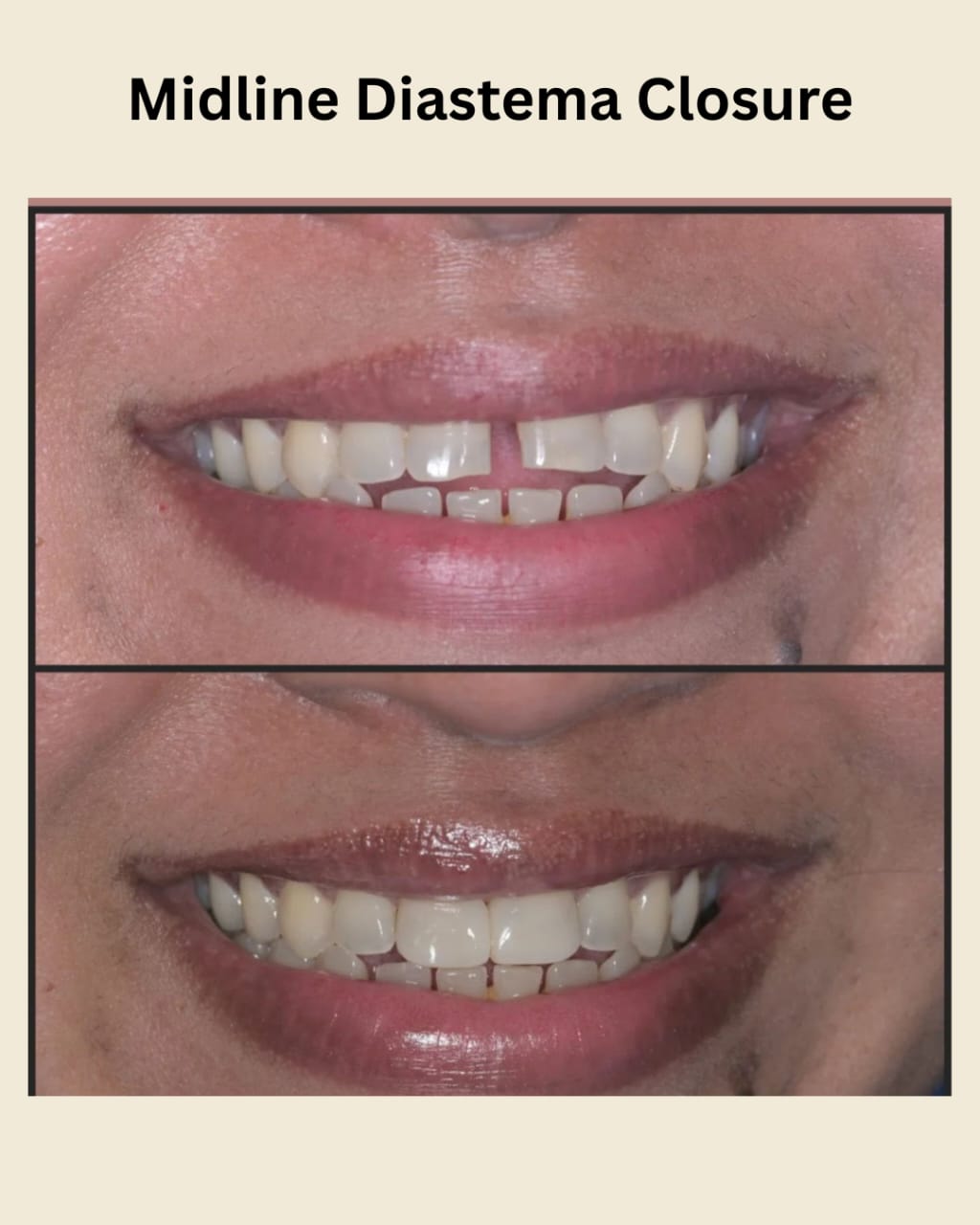Patient smile at Indu Dental Clinics