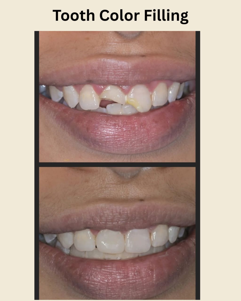 Patient smile at Indu Dental Clinics